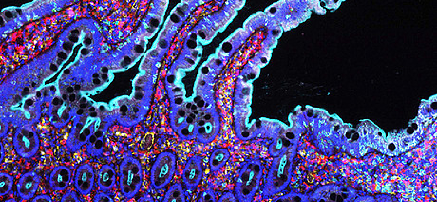 Ein farbiges Bild einer mikroskopischen Aufnahme menschlicher Zellen