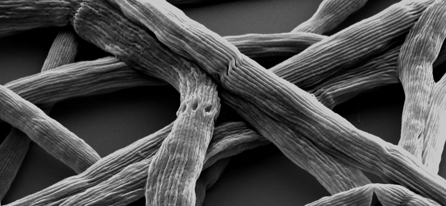 Kabelbakterium vergrößert