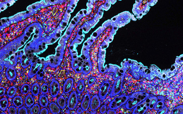Ein farbiges Bild einer mikroskopischen Aufnahme menschlicher Zellen