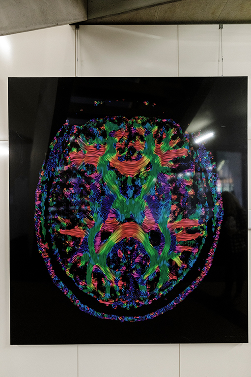 Magnetresonanz-Aufnahme des menschlichen Gehirns