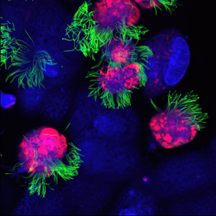 Eine farbige mikroskopische Aufnahme menschlicher Zellen.